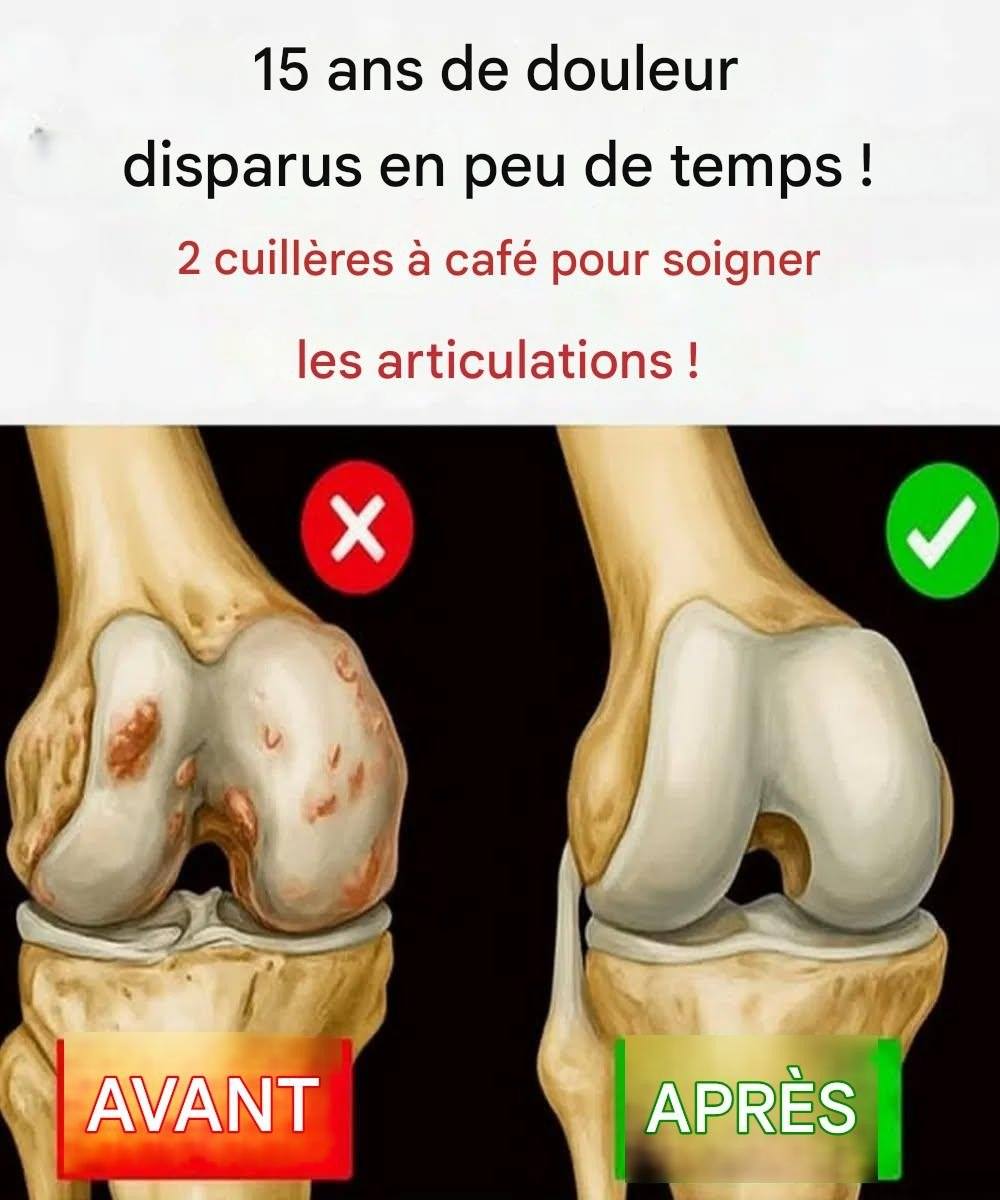 15 ans de douleurs disparues en peu de temps ! Découvrez le secret du soulagement des articulations !