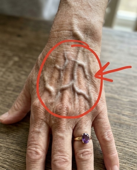 Si vos veines sont visibles, voici ce que cela signifie