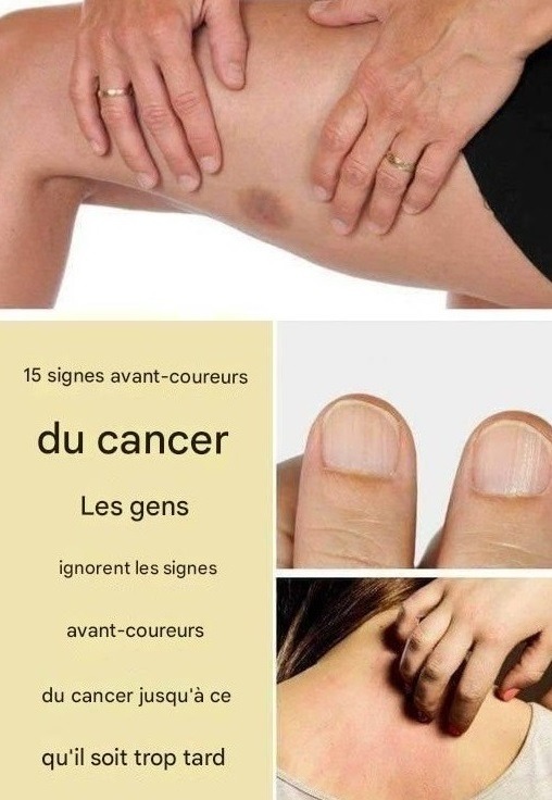 15 Signes d’alerte du cancer que les gens ignorent jusqu’à ce qu’il soit trop tard