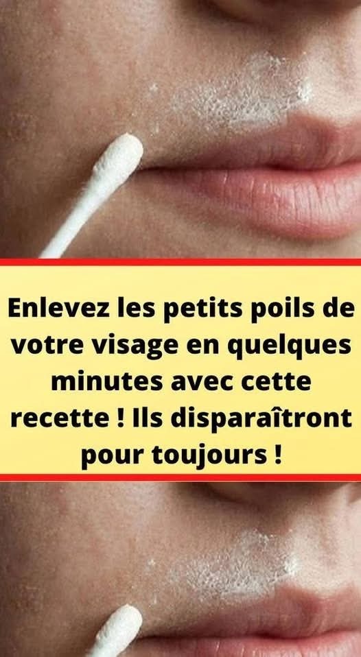 Cette recette naturelle éliminera définitivement les poils de votre visage
