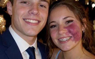 Un seul garçon m’a invitée au bal de l’école, car personne d’autre ne voulait y aller à cause du grain de beauté que j’avais sur le visage. Tout le monde a ri, jusqu’à ce que des policiers entrent dans le gymnase.