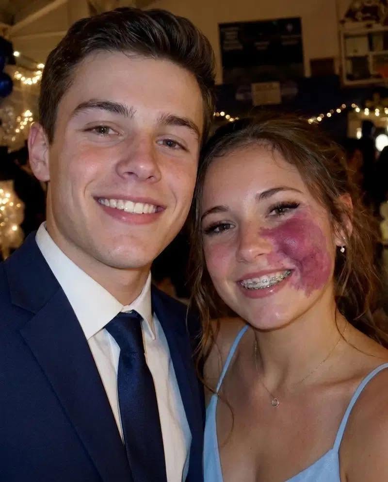 Un seul garçon m’a invitée au bal de l’école, car personne d’autre ne voulait y aller à cause du grain de beauté que j’avais sur le visage. Tout le monde a ri, jusqu’à ce que des policiers entrent dans le gymnase.