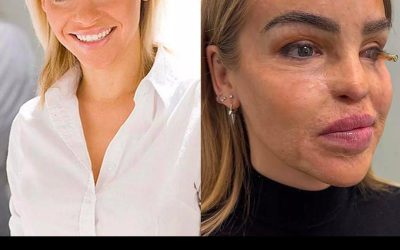 « J’en suis arrivée au bout du chemin » : le message émouvant de Katie Piper, la présentatrice de télévision qui a subi une violente attaque à l’acide il y a 16 ans
