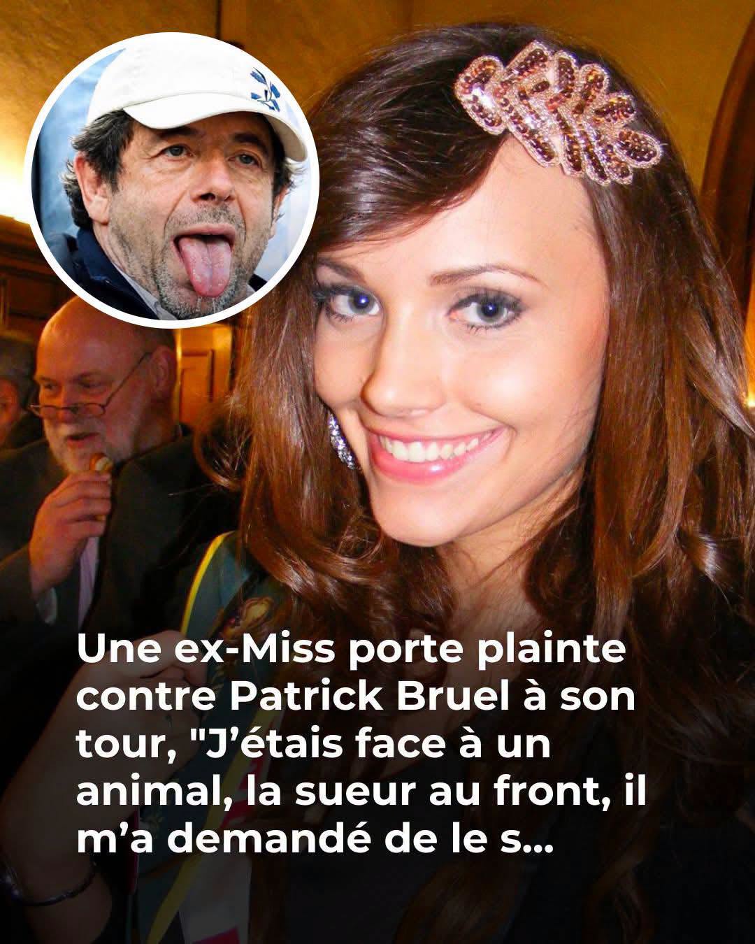 Une ex-Miss porte plainte contre Patrick Bruel pour viol : “J’étais face à un animal, la sueur au front”