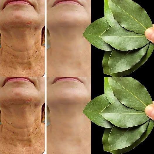 La feuille de laurier est-elle 100 000 fois plus puissante que le Botox ? | Une méthode naturelle pour estomper les rides, même à 70 ans !