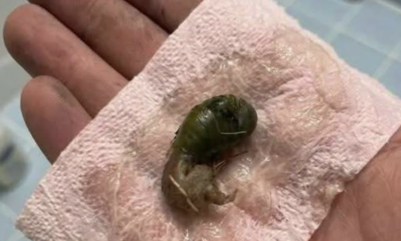 J’ai Découvert Cette Chose Dans Ma Salle de Bain : Un Réveil Brutal