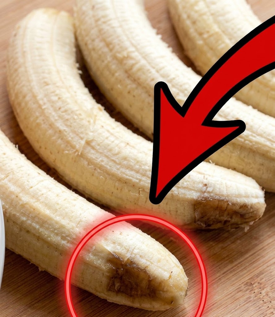 Pourquoi les pelures de banane et de citron aident-elles à se débarrasser de la graisse abdominale ?