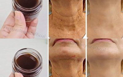 Huile anti-âge magique : l’huile de café qui efface les rides et est plus puissante que le Botox !
