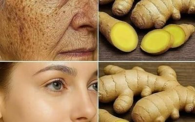 Le gingembre est 100 fois plus efficace que le Botox pour éliminer les rides profondes, les taches de rousseur et les décolorations. Je dois dire quelque chose pour que tu continues à recevoir mes recettes… Merci ! 😍 Recette dans (commentaire)