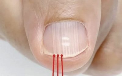Si vous avez ces lignes sur vos ongles après 40 ans, c’est un signe clair que… Lire la suite dans le premier commentaire.👇👇💬