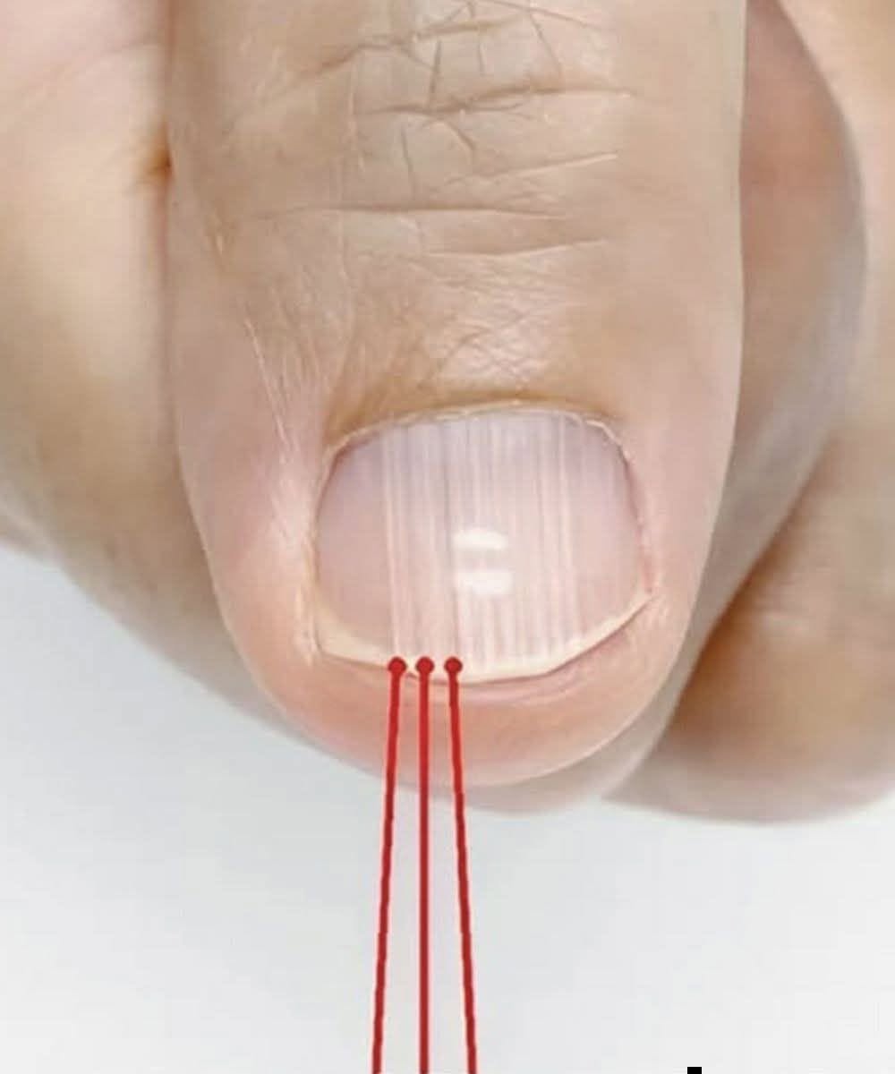 Si vous avez ces lignes sur vos ongles après 40 ans, c’est un signe clair que… Lire la suite dans le premier commentaire.👇👇💬