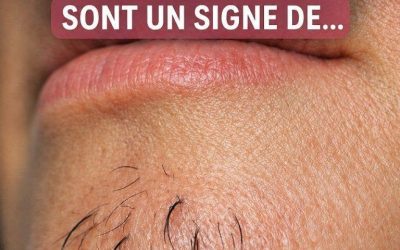 Si vous êtes une femme avec des poils au menton, soyez attentive. Voici ce que cela signifie