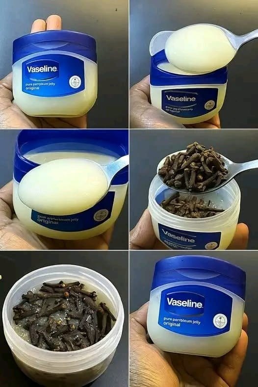 Mélangez des clous de girofle avec de la vaseline : un secret que personne ne vous révélera jamais. Vous me remercierez plus tard.